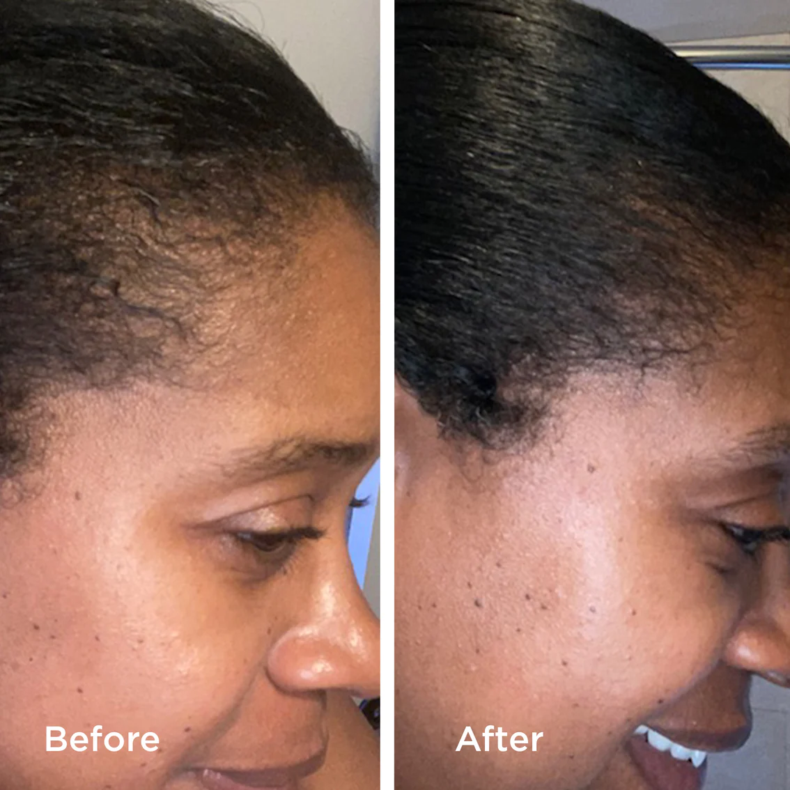 Rice Water Ritual Set - 3-Step Rice Water Hair Care System – Promotes Growth, Reduces Shedding, and Strengthens Strands
