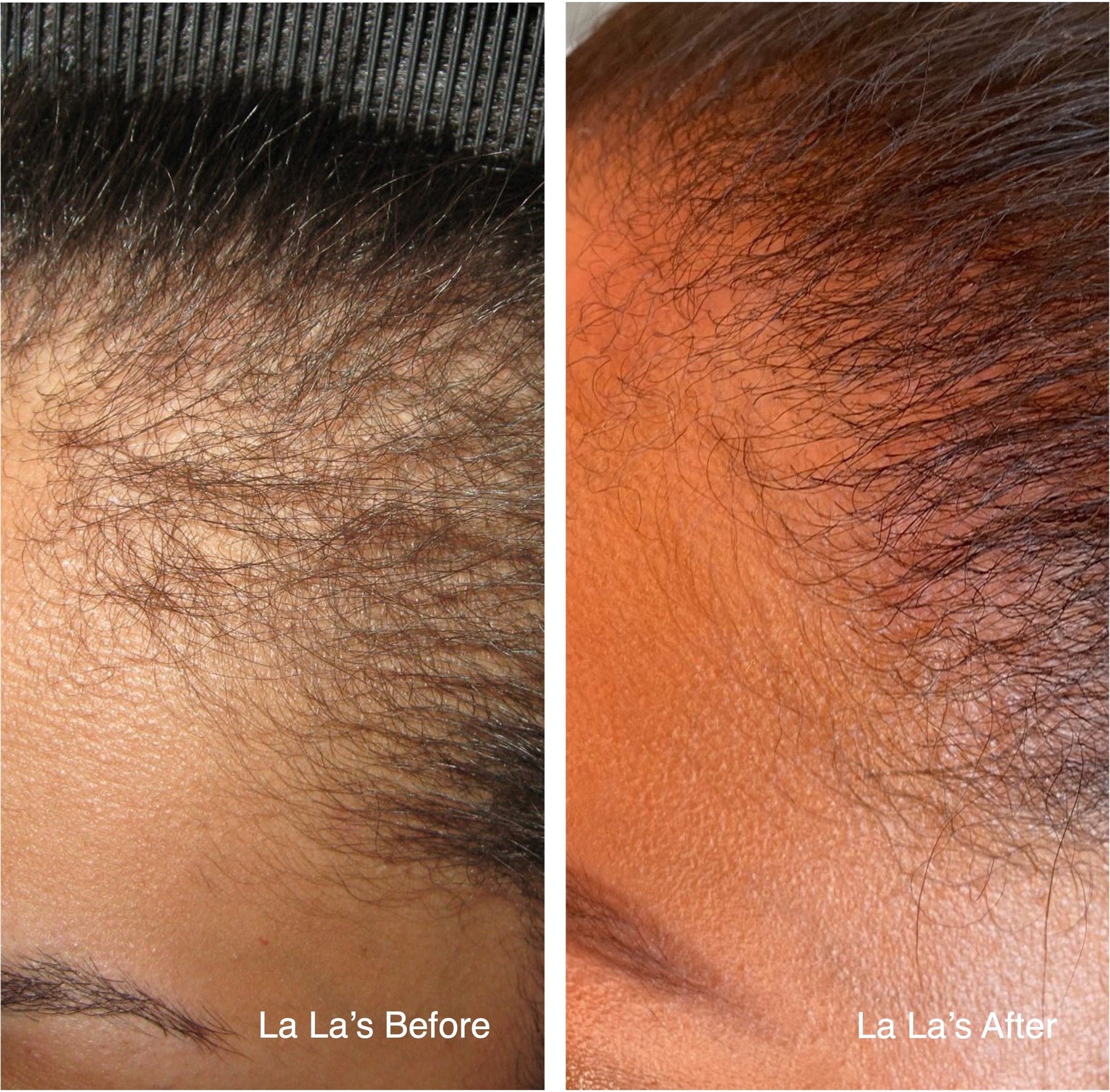 Rice Water Ritual Set - 3-Step Rice Water Hair Care System – Promotes Growth, Reduces Shedding, and Strengthens Strands