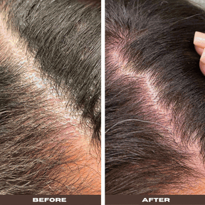 Good Biome Scalp Prebiotic Solution: Herbal Liquid Leave-In