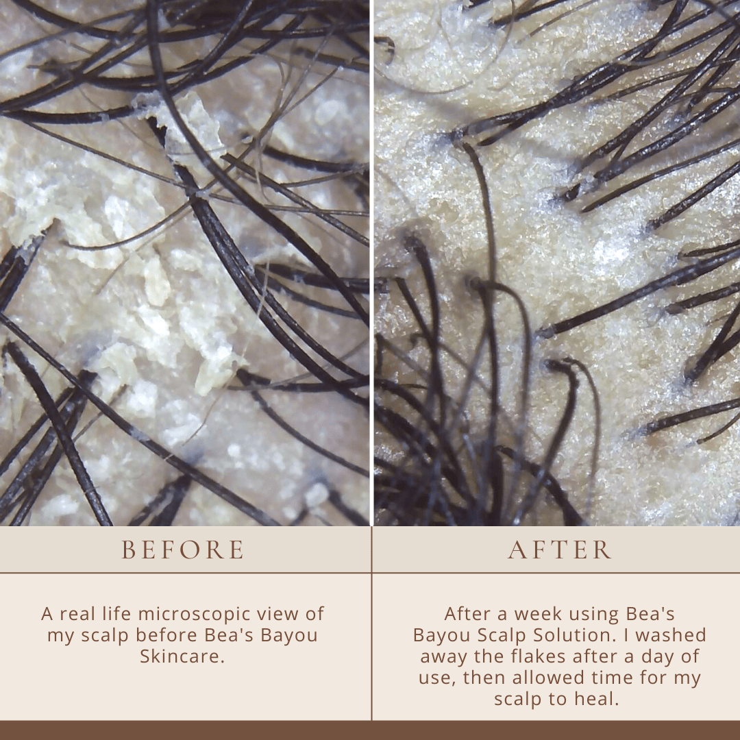 Good Biome Scalp Prebiotic Solution: Herbal Liquid Leave-In